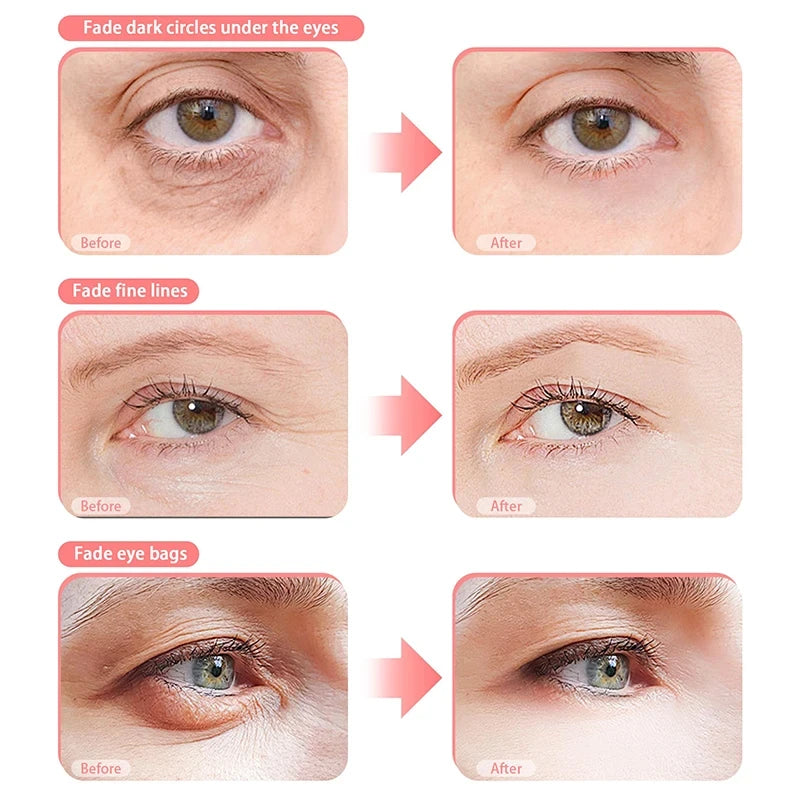 AuraVision™ Pro 3D Eye Massage