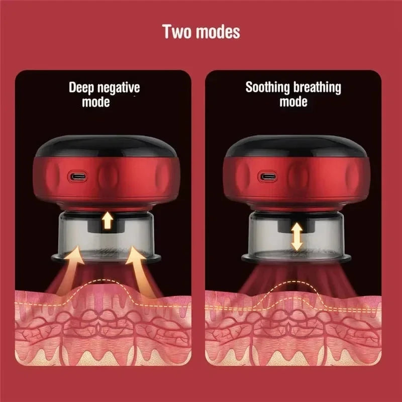 Wireless Electric Vacuum Cupping Set